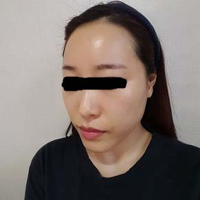 0fac65906b314e8eef4aea4f3e332c61.jpg