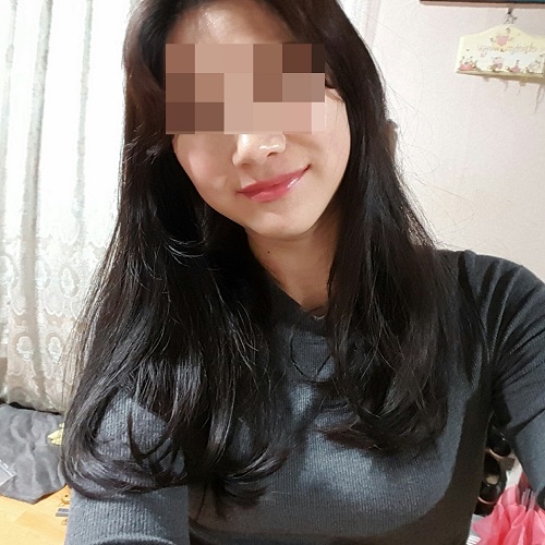 양악윤곽수술 5개월차 입니다!