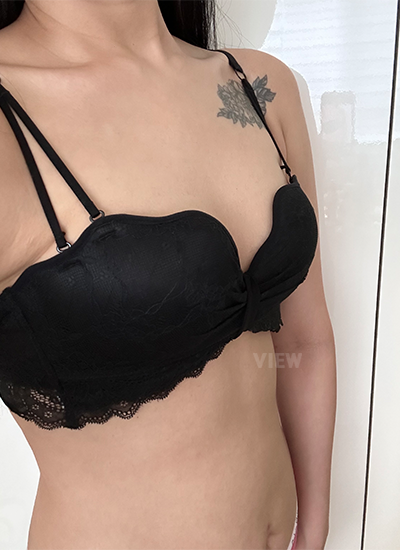 Review Klinik Bedah Plastik View, Sedot Lemak Liposuction