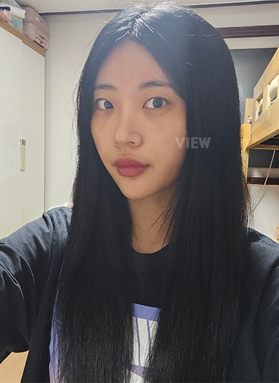 Review View Plastic Surgery, operasi mata, operasi lipatan mata, operasi revisi mata