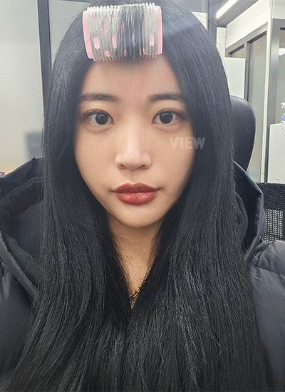 Operasi sudut belakang mata, Operasi sudut bawah mata 