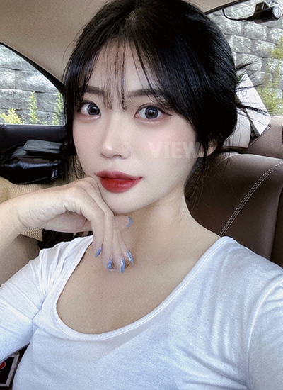 review double eyelid surgery di korea