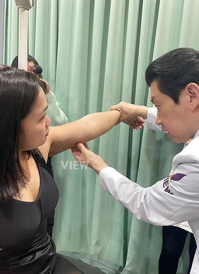 sedot lemak lengan, arms liposuction