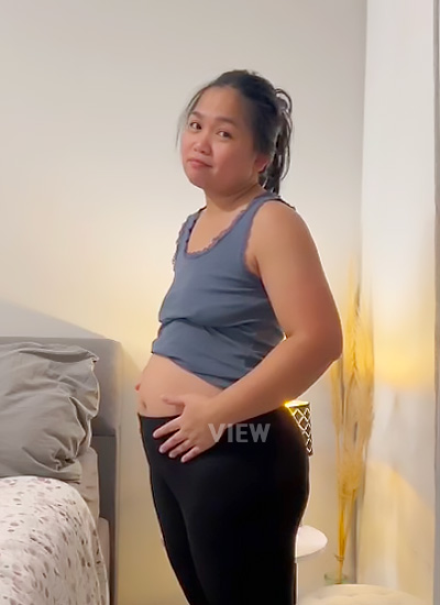 operasi tummy tuck, tummy tuck di Korea