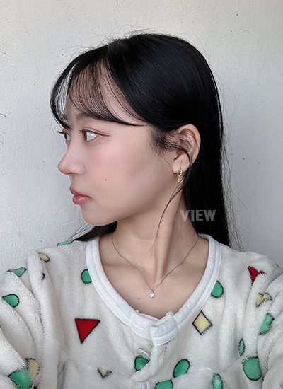 oplas wajah di Korea