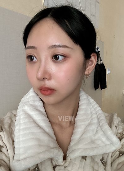 Operasi rahang di View Plastic Surgery