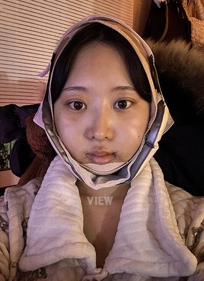 Perawatan setelah Operasi, Panduan setelah Operasi