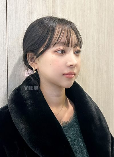 Review Operasi Kontur Wajah Korea