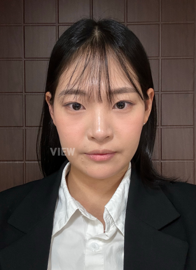 sebelum operasi hidung di Korea