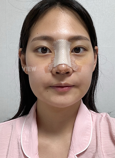Klinik oplas terbaik di Korea