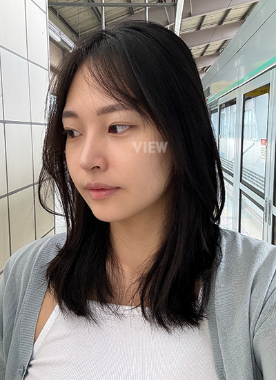 review 1 bulan setelah operasi hidung di Korea