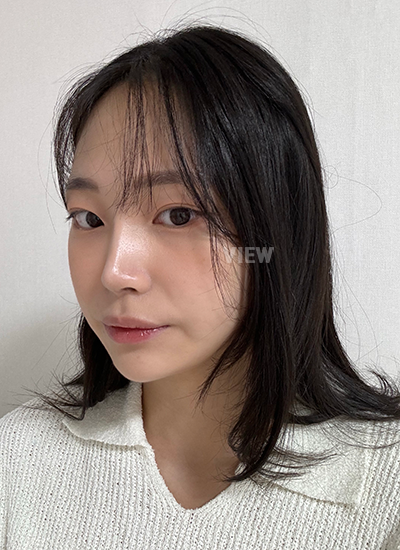 review 2 bulan setelah operasi hidung
