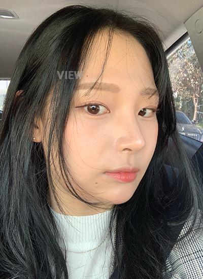 nyeri setelah operasi hidung