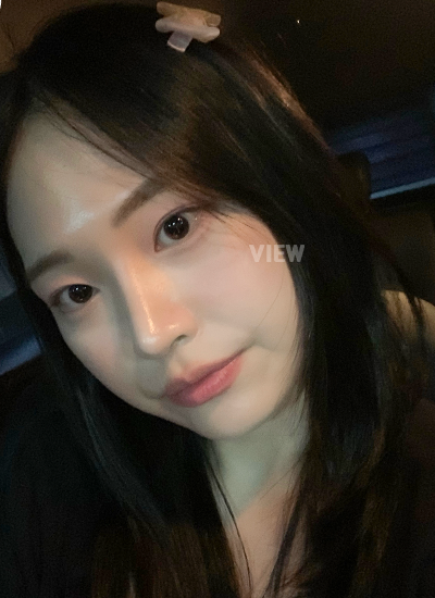 operasi hidung di Seoul, Review operasi hidung di View Plastic Surgery