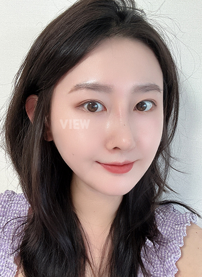hasil operasi plastik di Korea