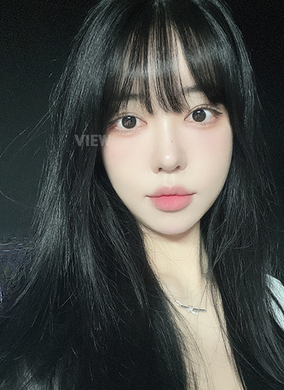 2 Bulan Pasca Operasi Plastik Korea