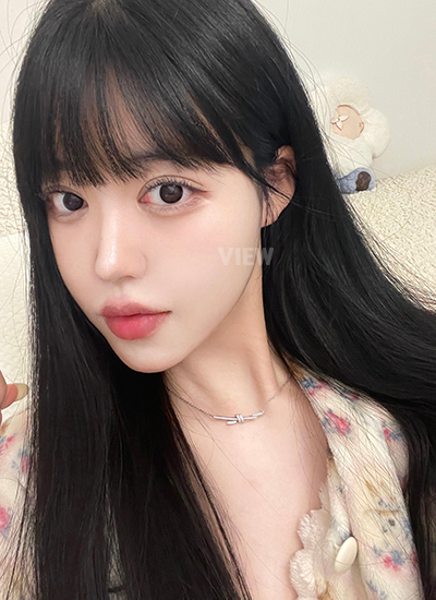 Bekas luka semakin membaik, dan fat grafting terasa halus.