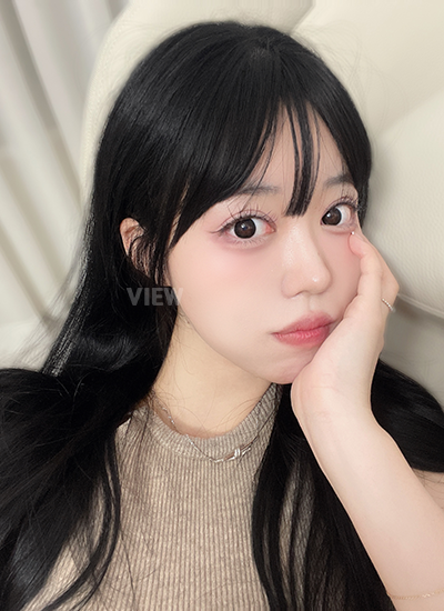 Tidak ada bekas luka, bahkan saya sendiri kadang lupa kalau pernah operasi.