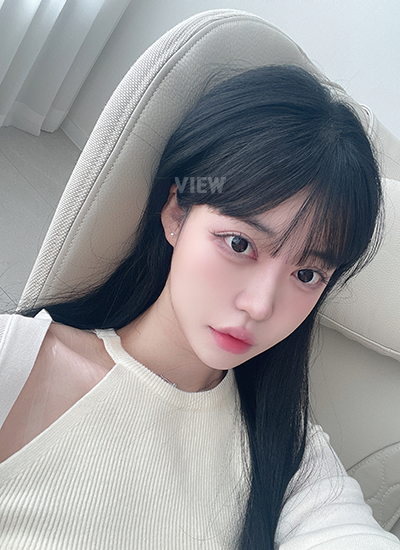 4 Bulan Hasil Operasi Plastik Korea