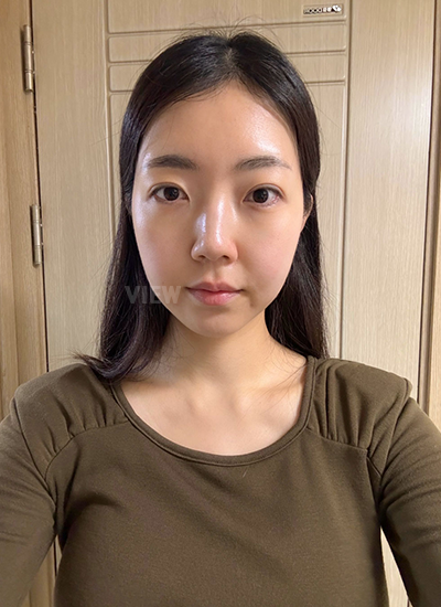 Review Konsultasi | Klinik Operasi Plastik Korea