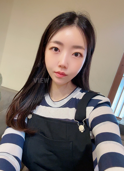 Sudah 1 bulan sejak saya menjalani operasi plastik di Korea, dan kontur wajah saya semakin jelas.