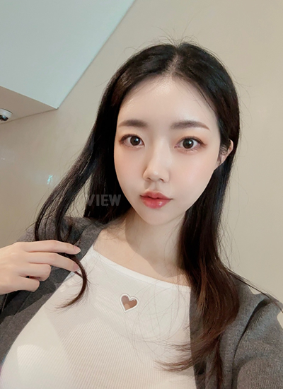 Dua bulan setelah operasi, bengkak hampir sepenuhnya hilang, dan wajah terasa alami saat digerakkan.