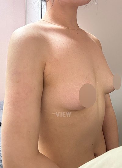 Konsultasi di Klinik VIEW Korea