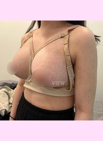 Setelah seminggu memakai upper band terus-menerus, rasanya sangat tidak nyaman.