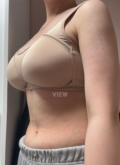 Pada bulan pertama, payudara terasa jauh lebih lembut!