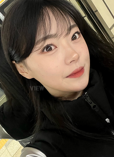 Kenapa Aku Masih Merasa Cemas dengan Pembengkakan 2 Bulan Setelah Facial Contouring Surgery?