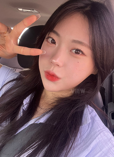 Kapan Aku Benar-Benar Menyadari Hasil Facial Contouring di Bulan ke-8?