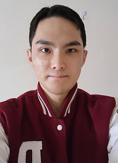 Sekarang sudah dua minggu sejak saya melakukan operasi plastik pria di Korea di View Plastic Surgery Korea.