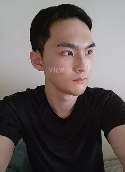 Sudah tiga minggu sejak saya melakukan operasi di View Plastic Surgery Korea, dan bengkak di wajah saya jauh berkurang dibandingkan sebelumnya.