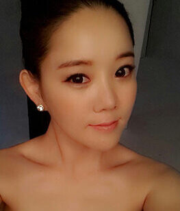 [Doll line (V line) + cheekbone reduction + anterior cheek implant + non-incision eyelid correction + eyebrow lift] Minah Lee