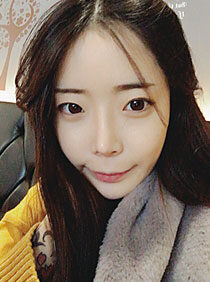 [Non-incision ptosis correction + hawk nose + fat grafting] Park Se-mi