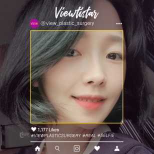 [3 Types Face Countouring+Thread Lift] Yoo Jina