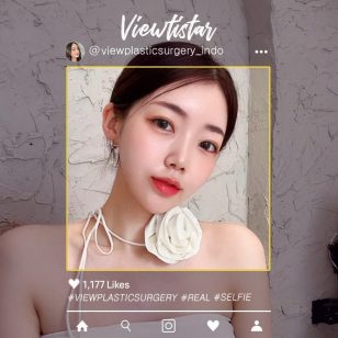 [Tarik Benang+Isi lemak+Sedot Lemak+Botox] Oh yumi | Plasitc Surgery Korea