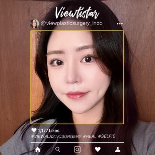 [Kontur Wajah 3 Jenis] Lee subin | Plastic Surgery Korea