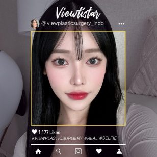 [Kontur Wajah 3 Jenis+Operasi Mata+Operasi Hidung] Koo Dohui | Plastic Surgery Korea