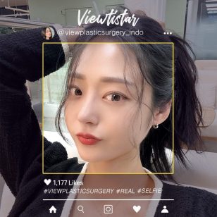 [Operasi Hidung + Reposisi Lemak Bawah Mata] Lee Hyeri | Plastic Surgery Korea