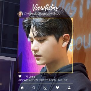 [Operasi Hidung] Kim Minseo | Plastic Surgery Korea