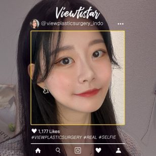 [Kontur Wajah, Operasi Mata, Tarik Benang] Wang Jungsuan | Plastic Surgery Korea