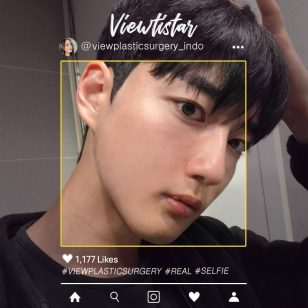 [Kontur Wajah 3 Jenis + Operasi Mata] Park Jinwon | Plastic Surgery Korea