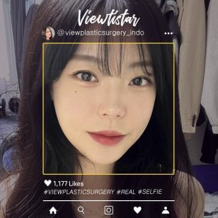 [Kontur Wajah 3 Jenis+Reposisi Lemak Bawah Mata+Isi lemak] Lee Minji | Plastic Surgery Korea